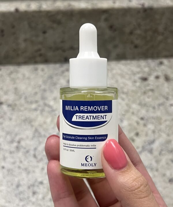 Milia Remover Treatment!